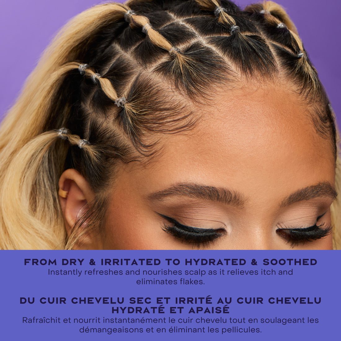 APPLE CIDER VINEGAR ANTI DANDRUFF LEAVE IN SERUM